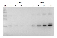 AHB2 | Hemoglobin 2 in the group Antibodies Plant/Algal / Environmental Stress / Plant Oxidative Stress at Agrisera AB (Antibodies for research) (AS13 2745)